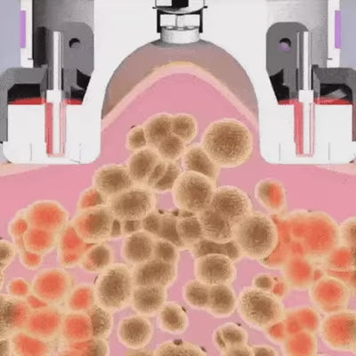 Dispozitiv de masaj corporal cu rezultate vizibile | FIDELO